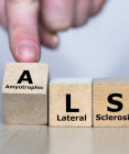 ALS choroba: Vážne ochorenie nervového systému, ktoré mení život. Čo o ňom vedieť?