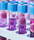 Tekutá biopsia: Revolúcia v diagnostike rakoviny? AI dokáže odhaliť nádor z krvi